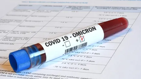 Care sunt simptomele specifice infecției cu Omicron? Medicii de la spitalele „Victor Babeş” şi „Matei Balş” din Capitală se pregătesc de valul 5