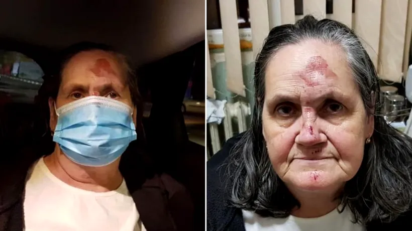 O femeie bolnavă de COVID s-a prăbușit în fața Spitalului Universitar din București! „Am găsit-o pe calea de acces a ambulanțelor”