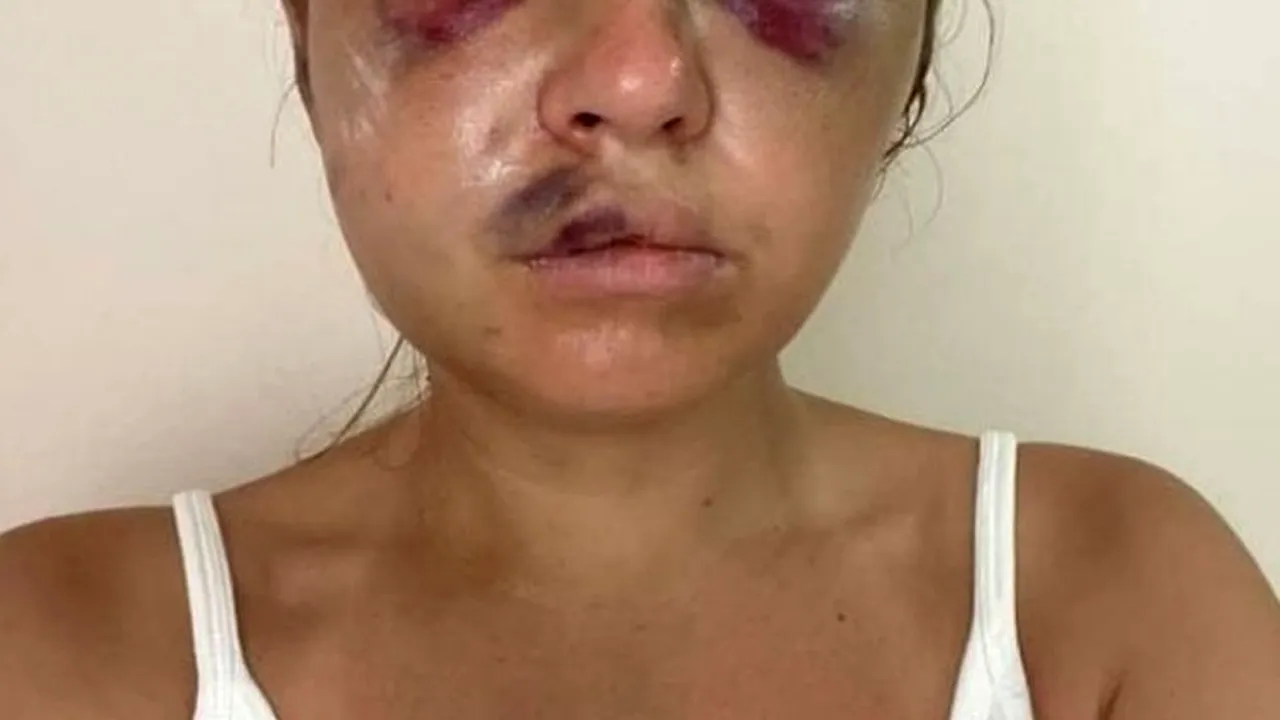 Vedetă TV, mutilată de un bărbat care a vrut să o violeze în fața fiului ei de șase ani. Cum a scăpat tânăra de 28 de ani din mâinile brutei