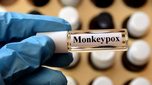 Epidemia de variola maimuței nu se va transforma într-o pandemie, apreciază OMS