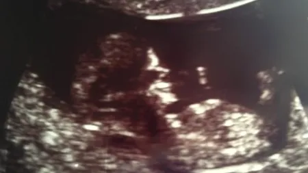 Ce l-a determinat pe un tată să publice ecografia cu viitorul său copil