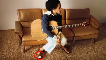 În 1977, Bob Marley a observat o zonă întunecată pe degetul mare de la piciorul drept. Juca fotbal și a crezut că s-a lovit. Când, în cele din urmă, a fost examinată, diagnosticul a fost crunt. 4 ani mai târziu, a murit