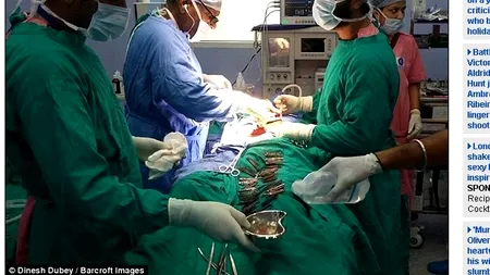 Medicii credeau că are o tumoare uriașă, dar el ascundea altceva în stomac: ''N-am mai văzut așa ceva''