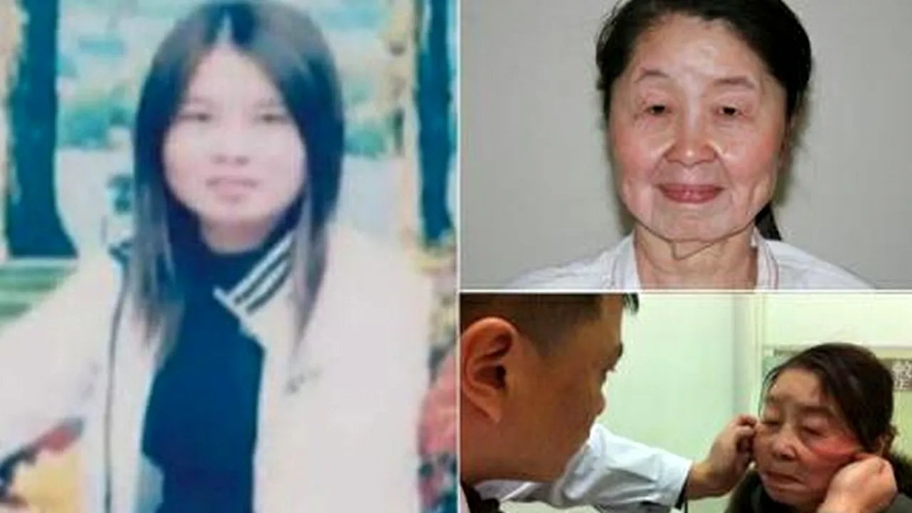 O chinezoaică suferă de o boală rară care o face să pară mai bătrână cu 40 de ani