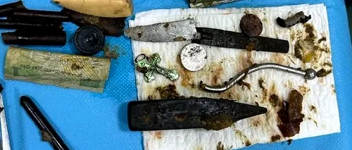 Caz șocant la IAȘI. Medicii au găsit în stomacul unui bărbat un ciocan, lame de cuțit și alte obiecte