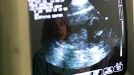 A purtat 40 de ani un „bebeluș de piatră