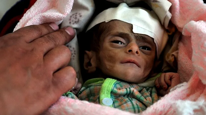 IMAGINEA DISPERĂRII: Yemen, țara unde milioane de oameni mor de foame, iar politicienii cer VOTURI CONTRA HRANĂ
