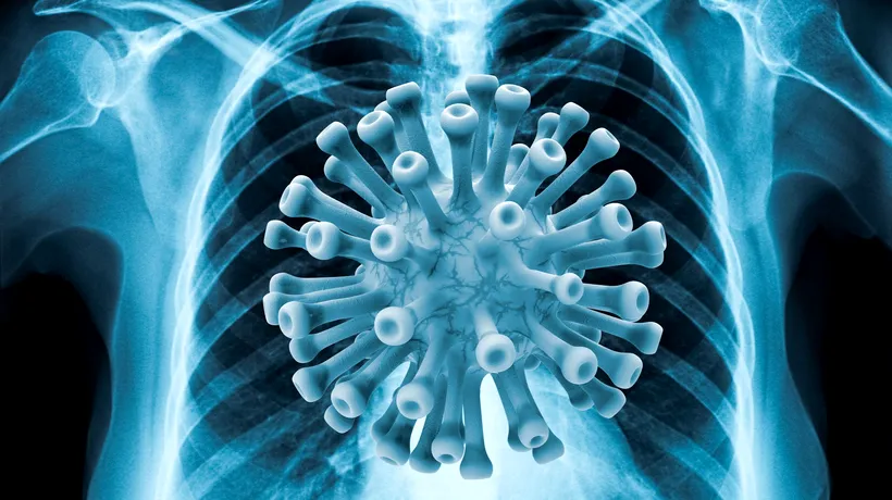 Medic pneumolog, despre modul în care SARS-CoV-2 infestează organismul: Există trei faze ale bolii