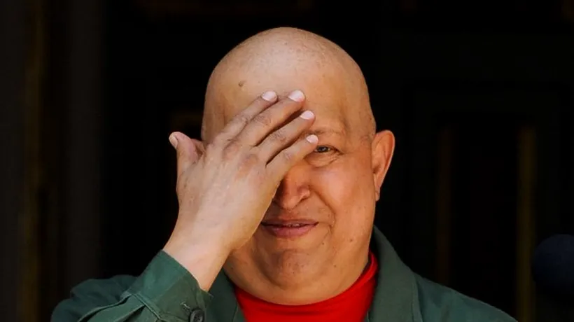 Hugo Chavez a suferit o hemoragie în urma operației