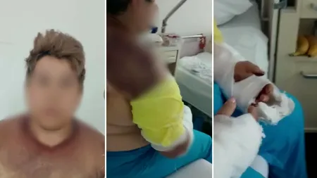 Mărturia șocantă a unei femei de Mehedinți, care a fost bătută de șeful ei dintr-un motiv incredibil. „De aici vie nu mai ieși, c***o!”