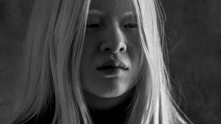 Bebelușul abandonat care a devenit model Vogue. Povestea impresionantă a lui Xueli Abbing, bolnavă de albinism - FOTO