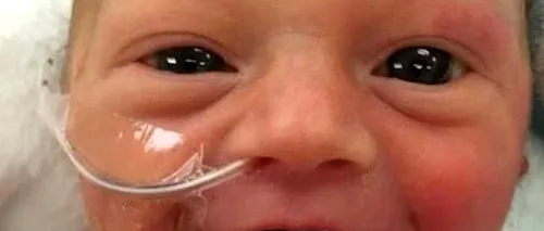 Născut prematur, a fost numit cel mai fericit bebeluș din lume. Fotografia care a emoționat o lume întreagă  