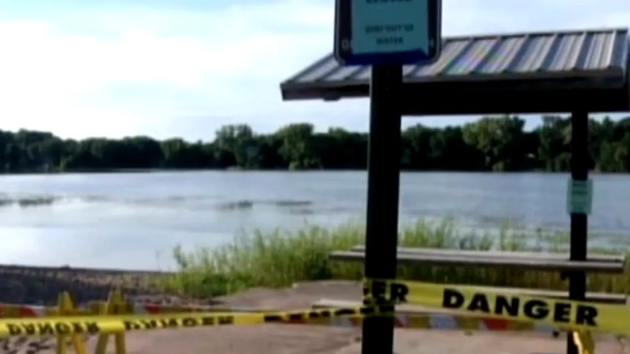 Un copil din SUA a murit după ce a fost infectat cu o amibă. 