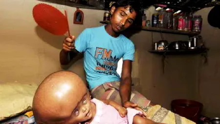 Fetița cu „cap de extraterestru