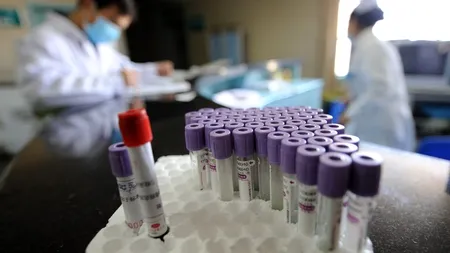 BREAKING NEWS. China emite alertă pentru o altă boală infecțioasă mortală și interzice consumul unor animale considerate riscante