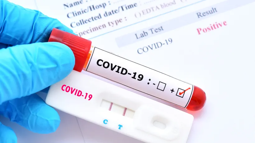 Ce trebuie să facă persoanele diagnosticate pozitiv cu COVID-19? Sfatul specialiștilor