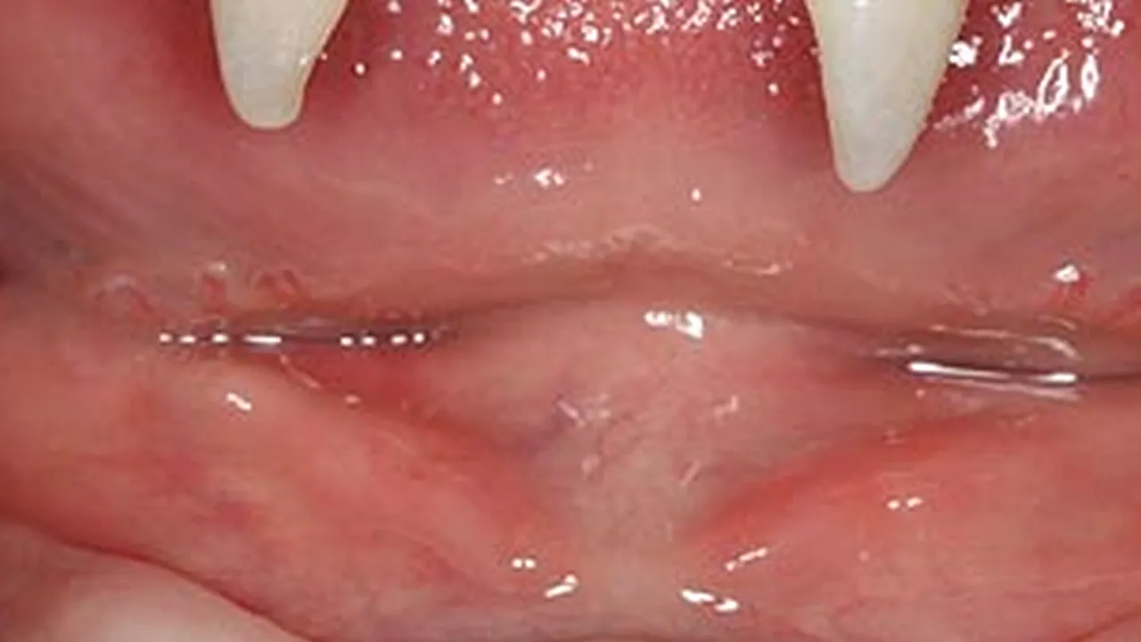 Băiatul cu dinți de vampir. 