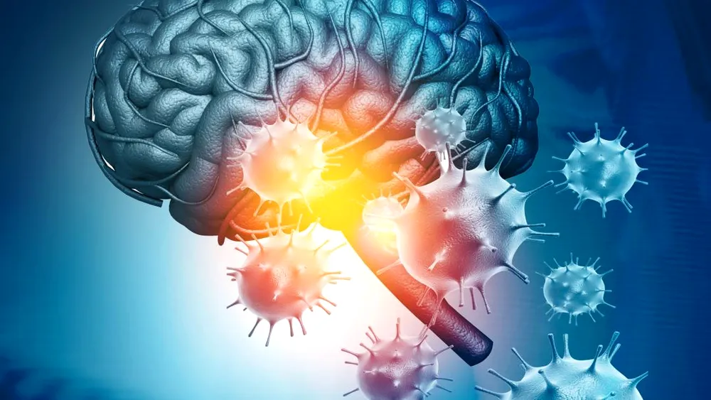 Covid-19 nu afectează doar plămânii. Cercetătorii au descoperit ce modificări poate provoca virusul în creier