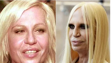 LOVITURĂ pentru divele care visau să întinerească peste noapte: Fără injecții cu BOTOX în perioada următoare, din cauza coronavirusului