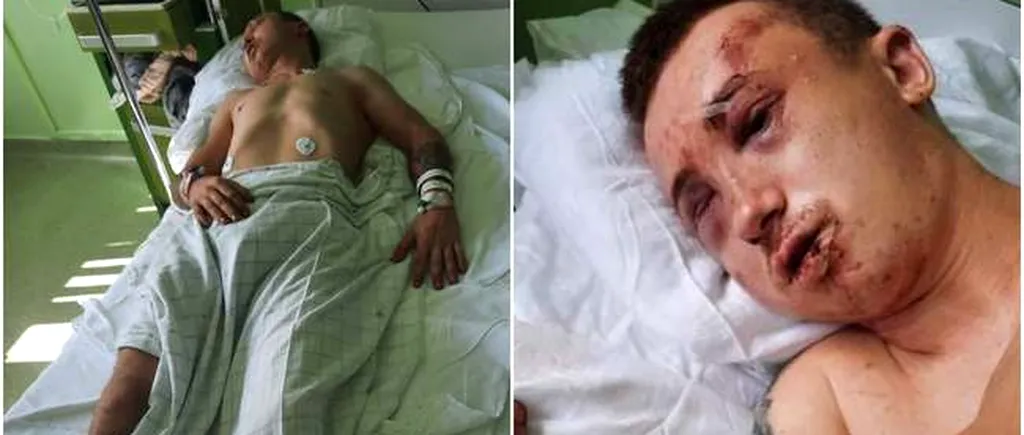 Un tânăr din Arad, la un pas de moarte. A fost bătut cu bestialitate, dezbracat și abandonat pe un trotuar