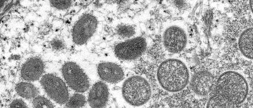 OMS susține că nu există dovezi privind mutaţii ale variolei maimuţei: „Este o situaţie care poate fi ţinută sub control. Transmiterea virusului poate fi oprită în țările non-endemice”