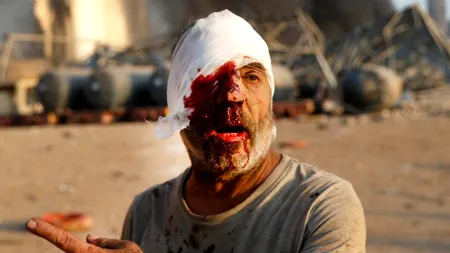 Declarația unui medic care a ajutat răniții din explozia din Beirut care a șocat o lume întreagă: „A fost cel mai rău lucru pe care l-am văzut vreodată”