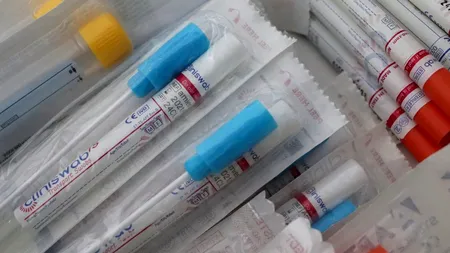 Republica Cehă  a adoptat măsura testării obligatorie în masă în companiile mijlocii şi mari. Acestea se expun la amenzi drastice dacă nu se supun noii reglementări