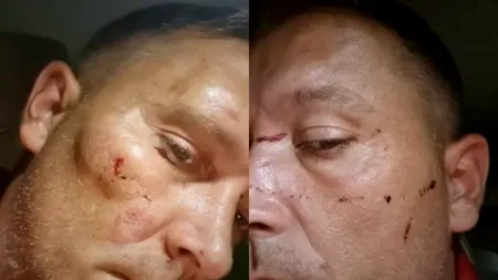 Bărbat, bătut cu bestialitate de trei indivizi când se întorcea de la un priveghi: „Siguranţa nu mai există”. Ce transmit autoritățile în urma atacului - VIDEO