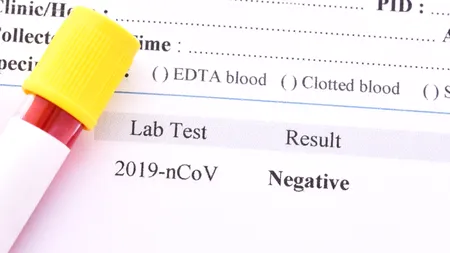 CORONAVIRUS. Un bărbat a murit, după ce a fost declarat vindecat