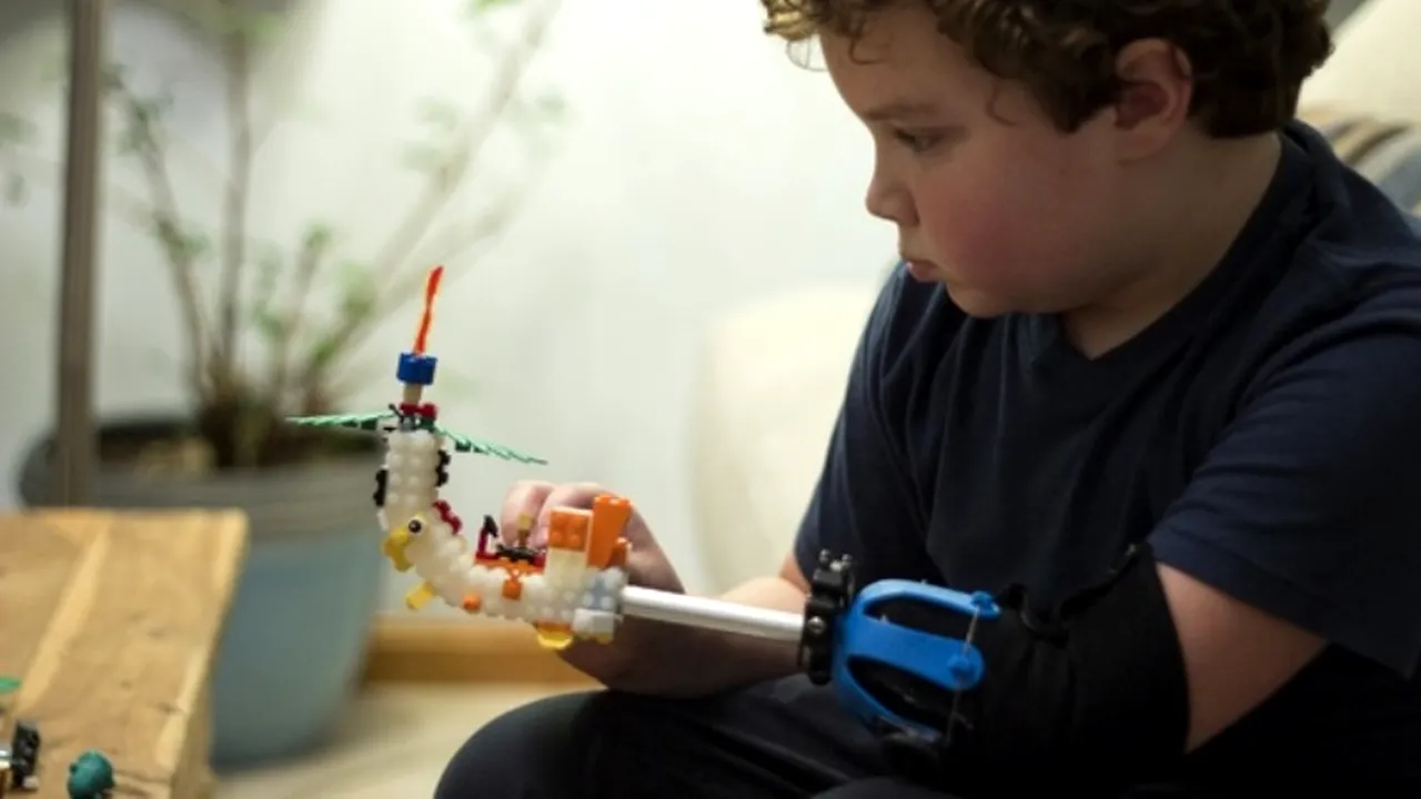Povestea impresionantă a băiatului de 9 ani care și-a construit  singur o proteză din piese Lego