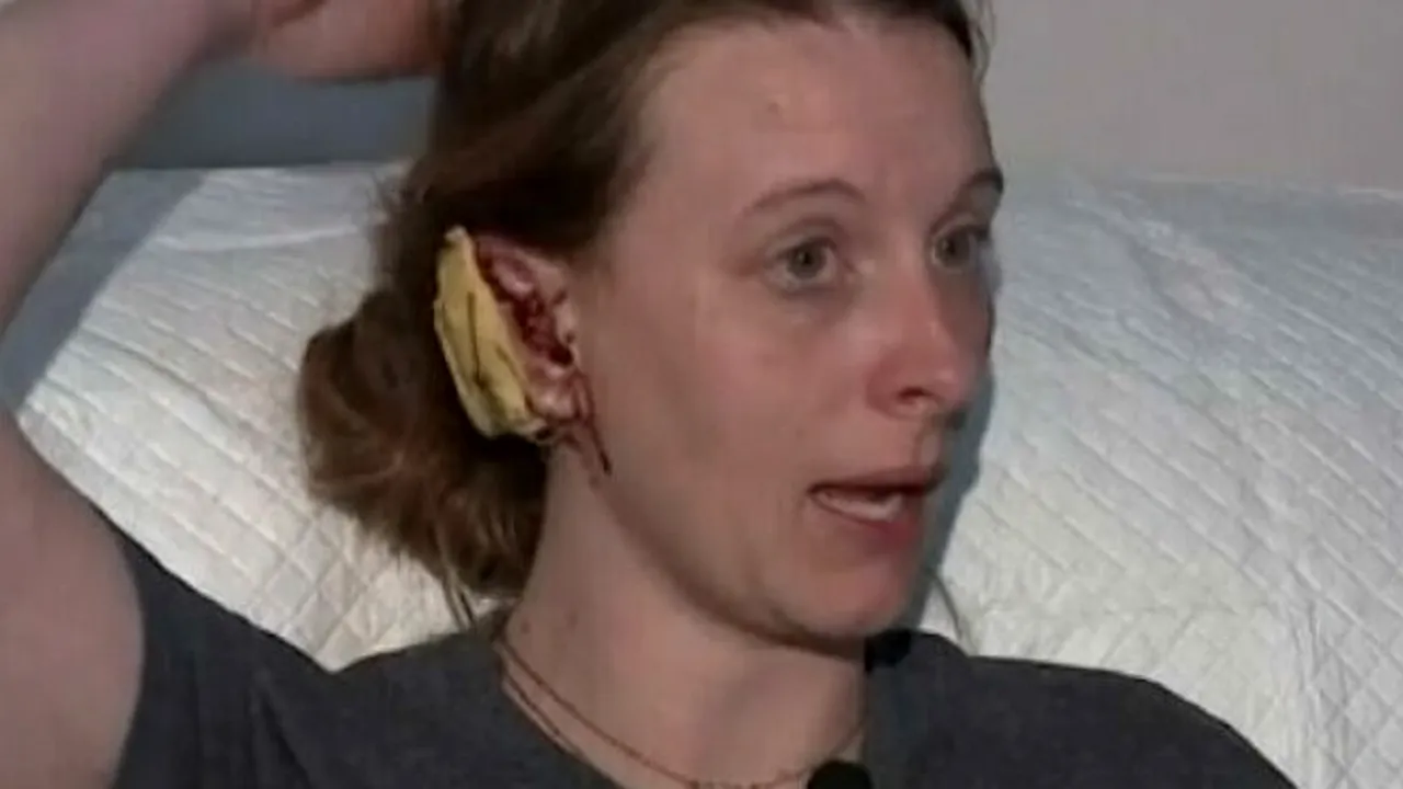 Femeie din SUA, MUTILATĂ de o maimuță! I-a rupt o ureche și a lăsat-o fără păr