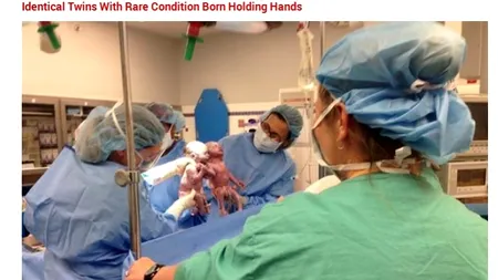 Gemenele care au venit pe lume ținându-se de mână. Retrospectivă 2014
