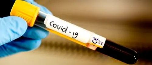 CREȘTERE EXPLOZIVĂ FĂRĂ PRECEDENT. În ultimele 24 de ore, au fost raportate 777 de noi cazuri de infectări cu coronavirus. În Municipiul București a fost raportat cel mai mare număr de cazuri de coronavirus în ultimele 24 de ore