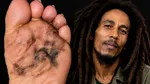 În 1977, Bob Marley a observat o zonă întunecată pe degetul mare de la piciorul drept. Juca fotbal și a crezut că s-a lovit. Când, în cele din urmă, a fost examinată, diagnosticul a fost crunt. 4 ani mai târziu, a murit