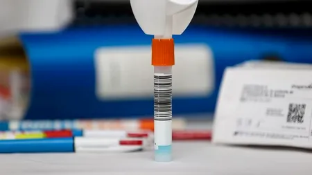 Trei firme împart 80 de milioane de lei, după ce și-au adjudecat primul lot al licitației ONAC pentru 70 de milioane de teste de salivă pentru școli