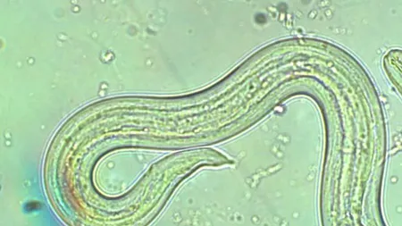 Turist în stare gravă, după un pariu cu prietenii. Aflat într-o destinație de vis, bărbatul a vrut să se dea mare și a făcut un gest de bravură / Creierul și măduva spinării, afectate în urma „cascadoriei