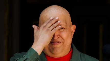 Hugo Chavez a suferit o 